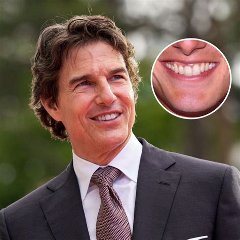 are tom cruse teeth fake